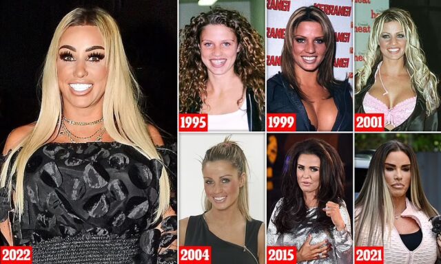 GOSSIP99 : Katie Price shows off her HUGE swollen lips