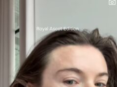 GOSSIP99 : Georgia Toffolo gets candid about her 17-year acne battle as she reveals another skin concern in Instagram vs reality clip after looking ‘perfect’ at Ascot