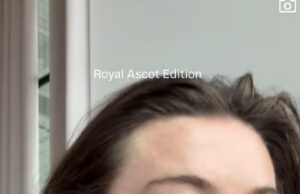 GOSSIP99 : Georgia Toffolo gets candid about her 17-year acne battle as she reveals another skin concern in Instagram vs reality clip after looking ‘perfect’ at Ascot