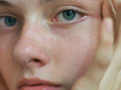 GOSSIP99 : Laser Vein Removal Transformed My Face, Here’s Why It Made Such A Difference