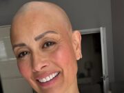 GOSSIP99 : Melanie Sykes proudly shows off her bald head days after admitting she had lost ‘two-thirds’ of her hair during distressing alopecia battle
