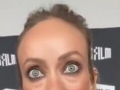 GOSSIP99 : Olivia Wilde says she ‘looked like a dead body’ and had ‘strangers diagnosing her with diseases’ as she speaks out on THAT concerning red carpet appearance going viral