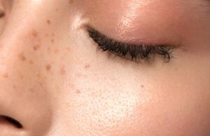 GOSSIP.CO.UK : The Best Bakuchiol Products For Retinol Results Without Any Irritation
